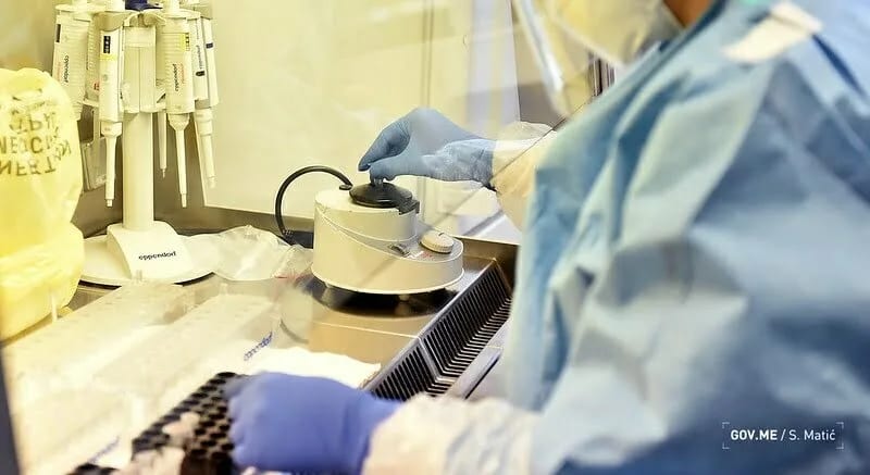 IJZ: 83 nova slučaja, bez preminulih