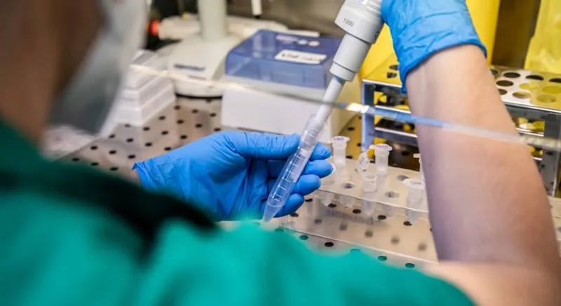IJZ: 83 nova slučaja, bez preminulih